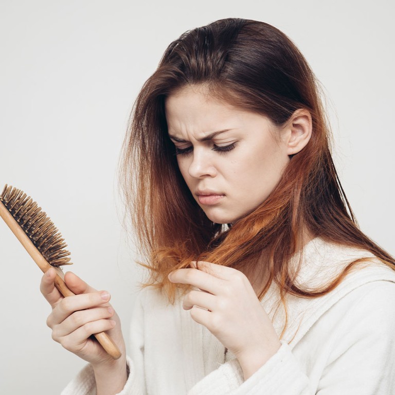Understanding and Managing Hair Loss: Causes, Symptoms, and Treatment Options
